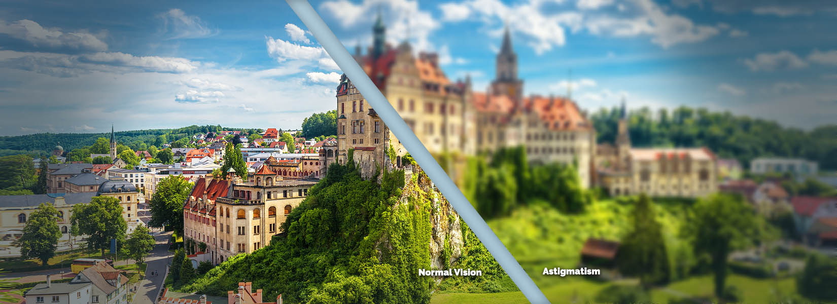 Astigmatism Treatment in Burleson